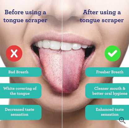 Tongue Scrapers Set (3 Pcs)